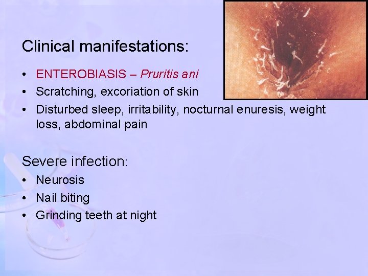 Clinical manifestations: • ENTEROBIASIS – Pruritis ani • Scratching, excoriation of skin • Disturbed