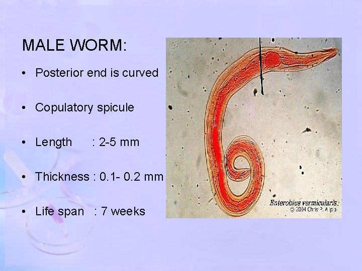 MALE WORM: • Posterior end is curved • Copulatory spicule • Length : 2