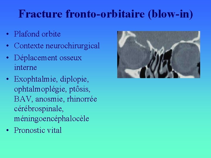 Fracture fronto-orbitaire (blow-in) • Plafond orbite • Contexte neurochirurgical • Déplacement osseux interne •