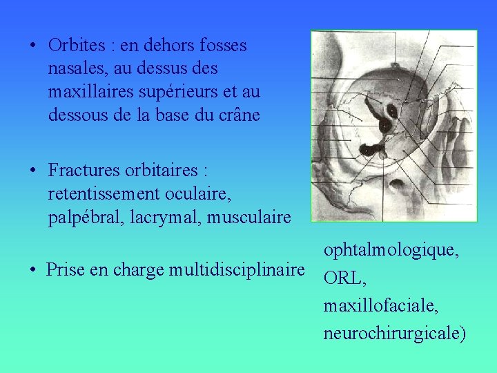  • Orbites : en dehors fosses nasales, au dessus des maxillaires supérieurs et