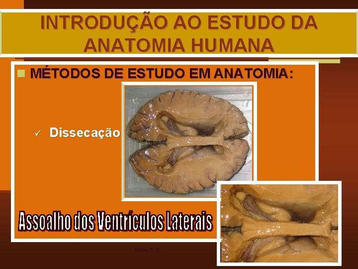 INTRODUÇÃO AO ESTUDO DA ANATOMIA HUMANA n MÉTODOS DE ESTUDO EM ANATOMIA: ü Dissecação