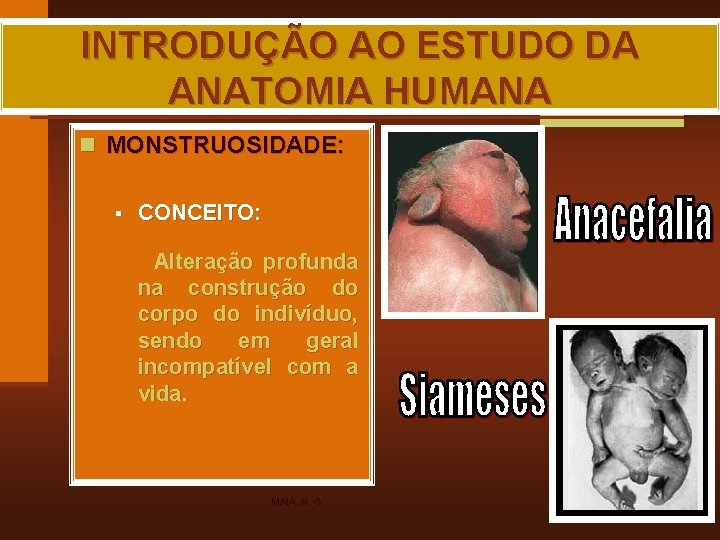 INTRODUÇÃO AO ESTUDO DA ANATOMIA HUMANA n MONSTRUOSIDADE: § CONCEITO: Alteração profunda na construção