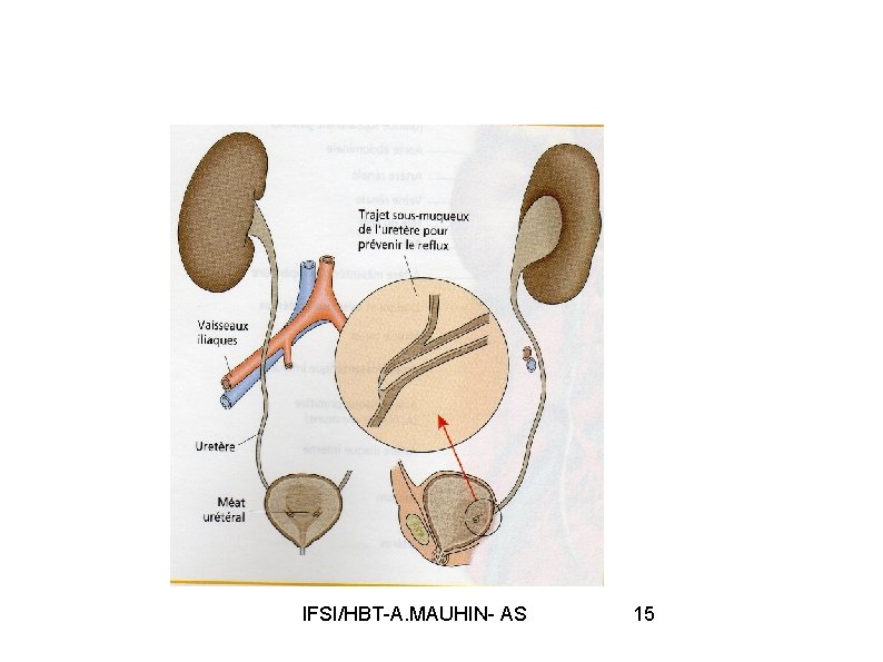 IFSI/HBT-A. MAUHIN- AS 15 