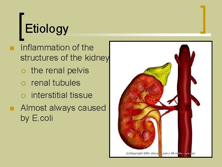 Etiology n n Inflammation of the structures of the kidney: ¡ the renal pelvis