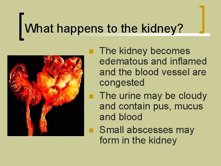 What happens to the kidney? n n n The kidney becomes edematous and inflamed
