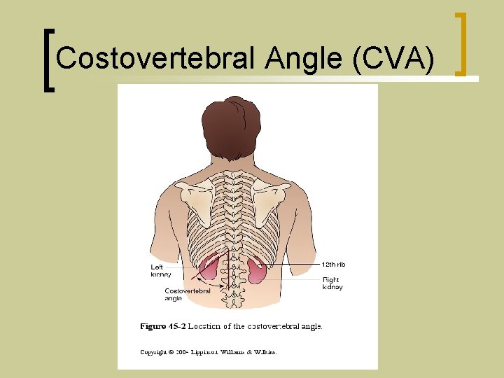 Costovertebral Angle (CVA) 