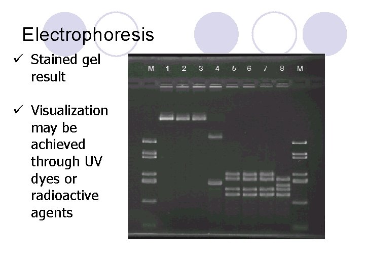 Electrophoresis ü Stained gel result ü Visualization may be achieved through UV dyes or