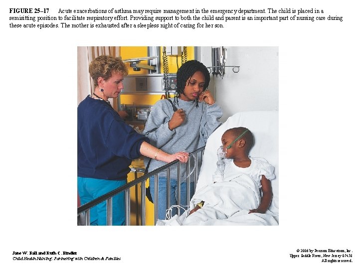 FIGURE 25– 17 Acute exacerbations of asthma may require management in the emergency department.