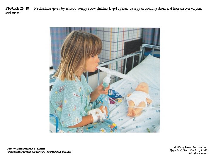 FIGURE 25– 18 and stress. Medications given by aerosol therapy allow children to get