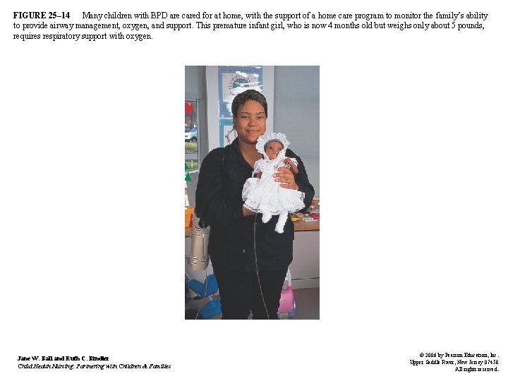 FIGURE 25– 14 Many children with BPD are cared for at home, with the