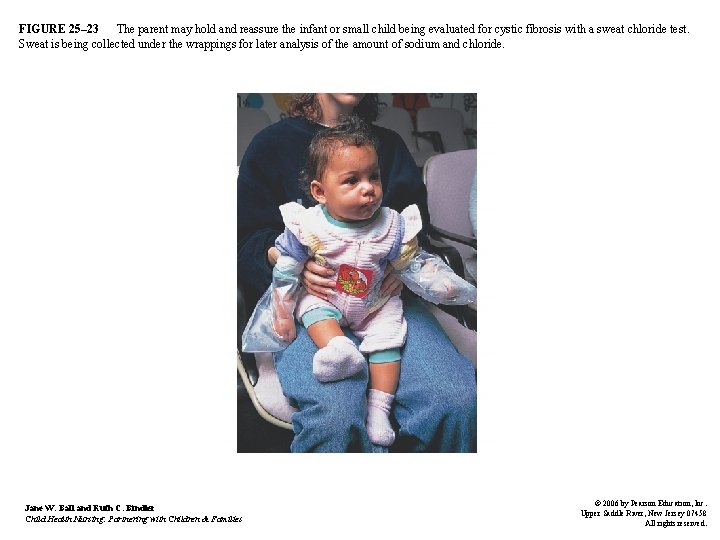 FIGURE 25– 23 The parent may hold and reassure the infant or small child