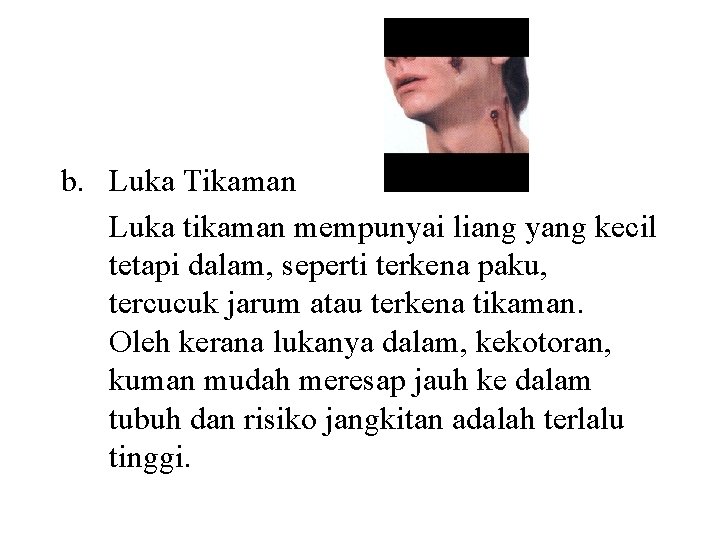 b. Luka Tikaman Luka tikaman mempunyai liang yang kecil tetapi dalam, seperti terkena paku,