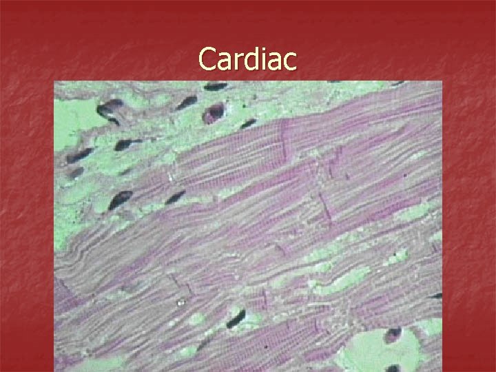 Cardiac 
