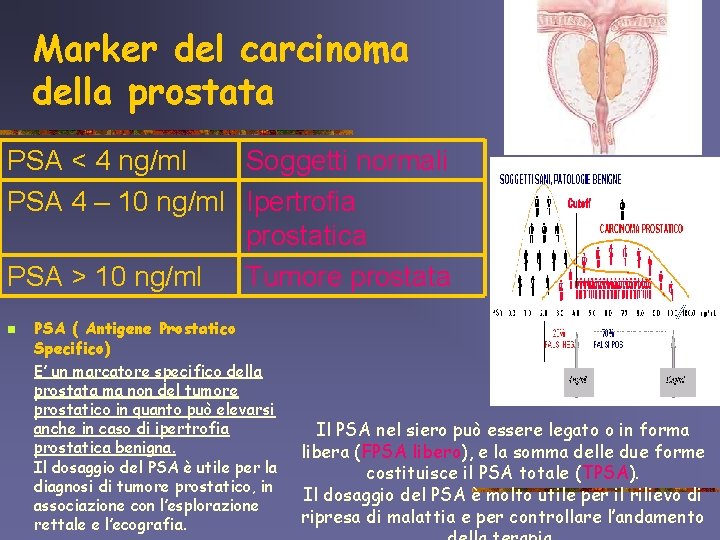 Marker del carcinoma della prostata PSA < 4 ng/ml Soggetti normali PSA 4 –
