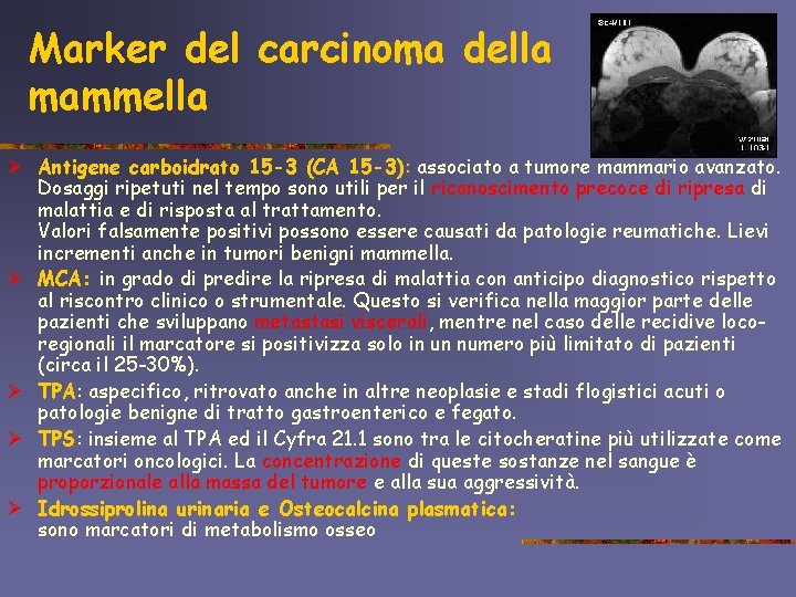 Marker del carcinoma della mammella Ø Antigene carboidrato 15 -3 (CA 15 -3): associato