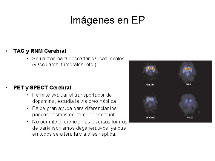 Imágenes en EP • TAC y RNM Cerebral • Se utilizan para descartar causas
