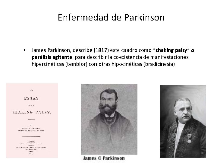 Enfermedad de Parkinson • James Parkinson, describe (1817) este cuadro como “shaking palsy” o
