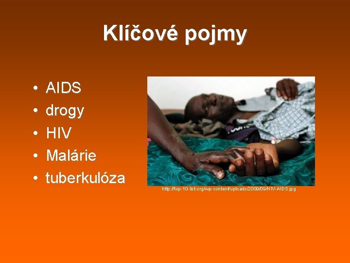 Klíčové pojmy • • • AIDS drogy HIV Malárie tuberkulóza http: //top-10 -list. org/wp-content/uploads/2009/09/HIV-AIDS. Klíčové pojmy • • • AIDS drogy HIV Malárie tuberkulóza http: //top-10 -list. org/wp-content/uploads/2009/09/HIV-AIDS.