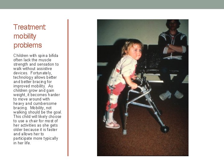 Treatment: mobility problems Children with spina bifida often lack the muscle strength and sensation