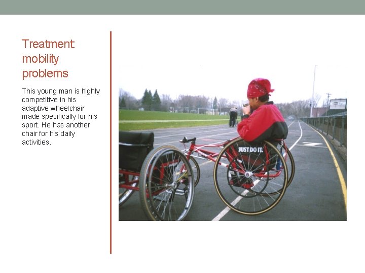 Treatment: mobility problems This young man is highly competitive in his adaptive wheelchair made