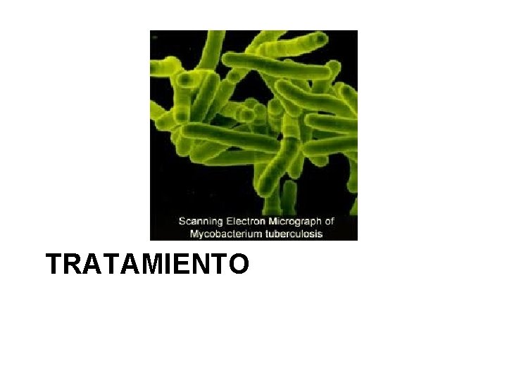 TRATAMIENTO 