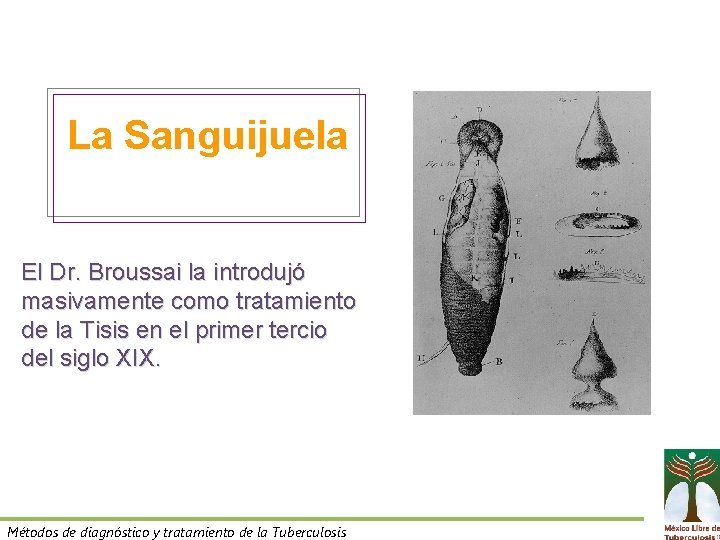 La Sanguijuela El Dr. Broussai la introdujó masivamente como tratamiento de la Tisis en