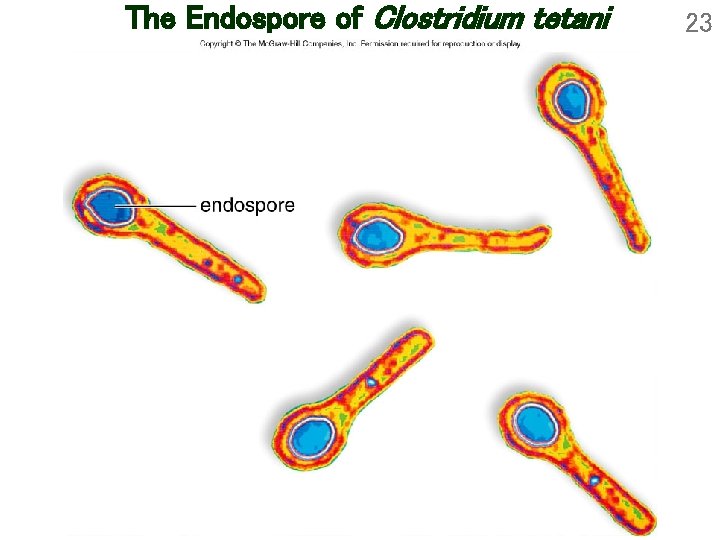 The Endospore of Clostridium tetani 23 