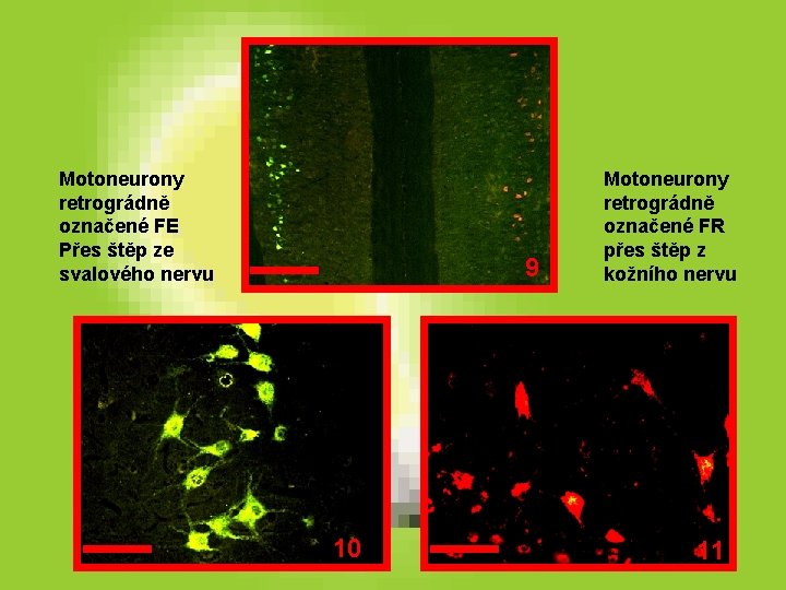 Motoneurony retrográdně označené FE Přes štěp ze svalového nervu 9 10 Motoneurony retrográdně označené Motoneurony retrográdně označené FE Přes štěp ze svalového nervu 9 10 Motoneurony retrográdně označené
