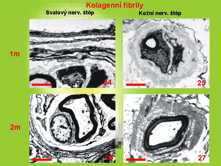 Kolagenní fibrily Svalový nerv. štěp Kožní nerv. štěp 1 m 24 25 26 27 Kolagenní fibrily Svalový nerv. štěp Kožní nerv. štěp 1 m 24 25 26 27