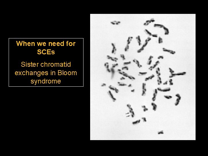 When we need for SCEs Sister chromatid exchanges in Bloom syndrome 
