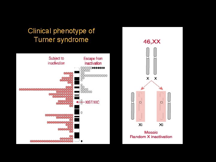 Clinical phenotype of Turner syndrome 