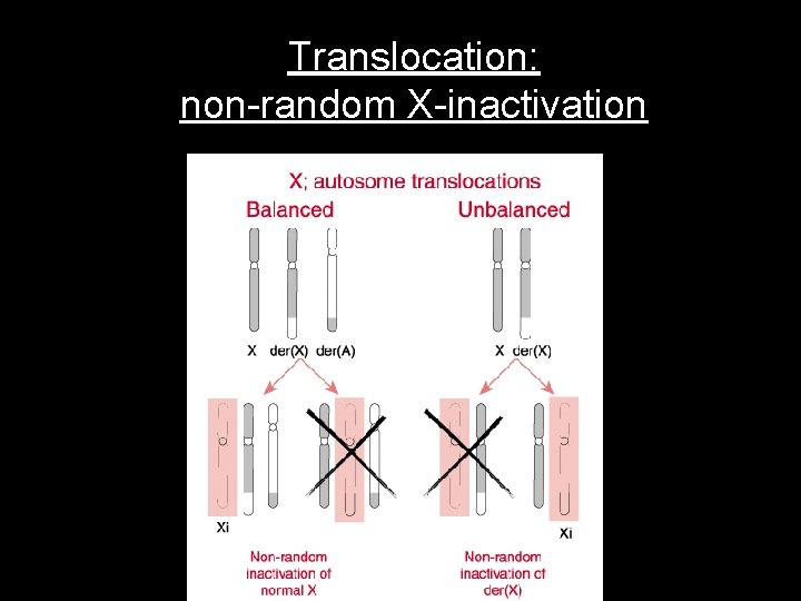 Translocation: non-random X-inactivation 