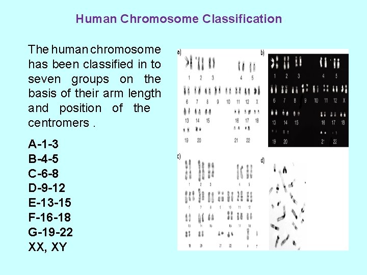Human Chromosome Classification The human chromosome has been classified in to seven groups on