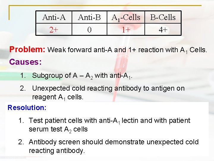 Anti-A 2+ Anti-B 0 A 1 -Cells 1+ B-Cells 4+ Problem: Weak forward anti-A