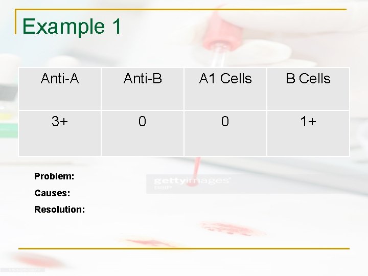 Example 1 Anti-A Anti-B A 1 Cells B Cells 3+ 0 0 1+ Problem: