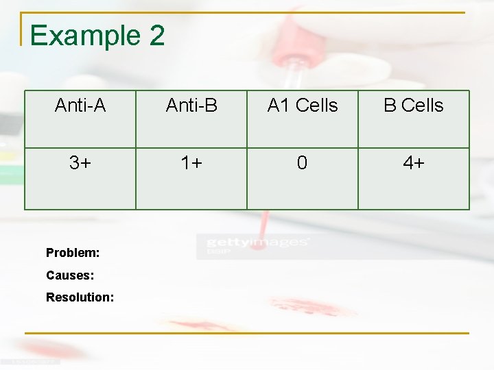 Example 2 Anti-A Anti-B A 1 Cells B Cells 3+ 1+ 0 4+ Problem: