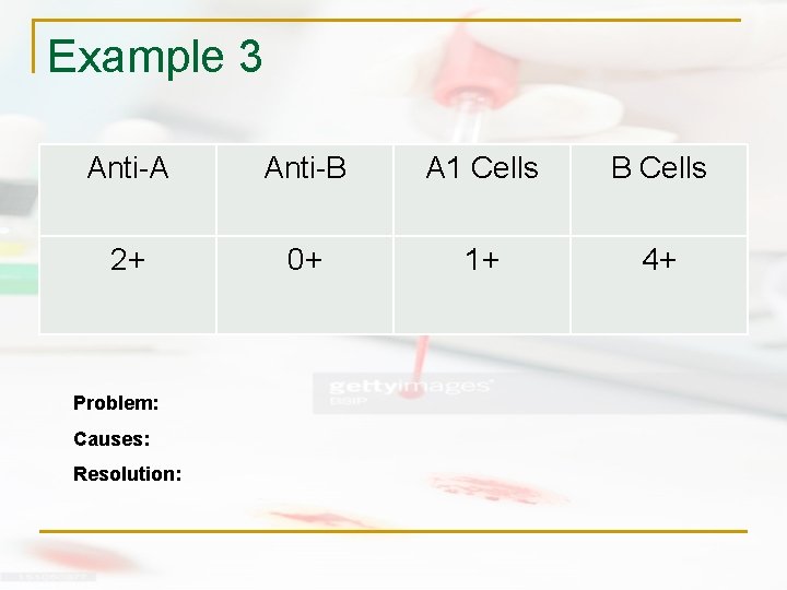 Example 3 Anti-A Anti-B A 1 Cells B Cells 2+ 0+ 1+ 4+ Problem: