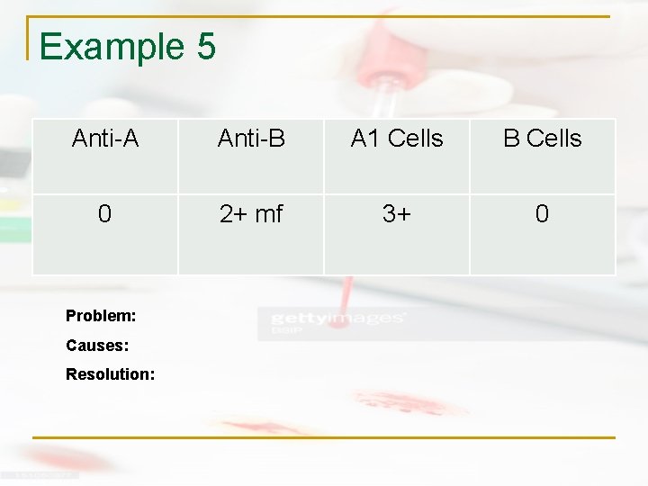 Example 5 Anti-A Anti-B A 1 Cells B Cells 0 2+ mf 3+ 0