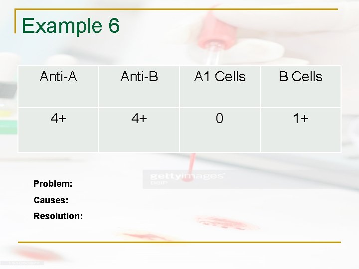 Example 6 Anti-A Anti-B A 1 Cells B Cells 4+ 4+ 0 1+ Problem: