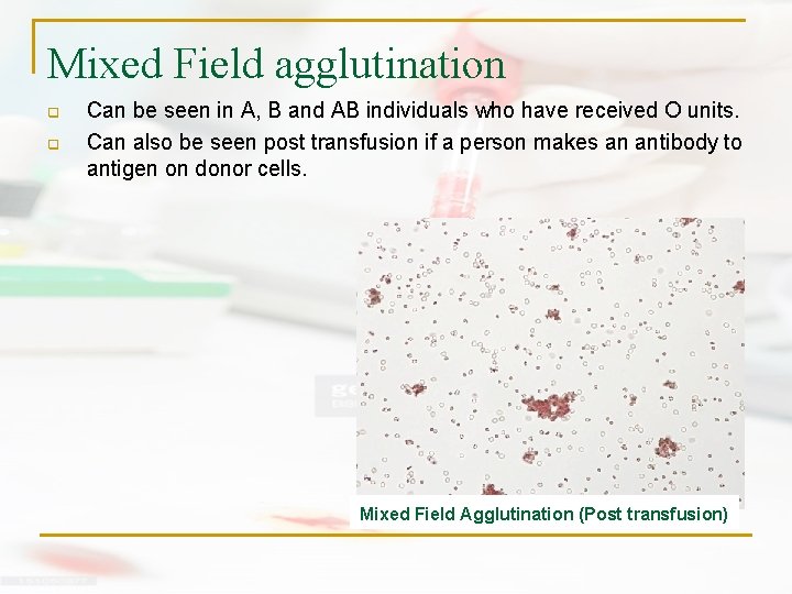 Mixed Field agglutination q q Can be seen in A, B and AB individuals