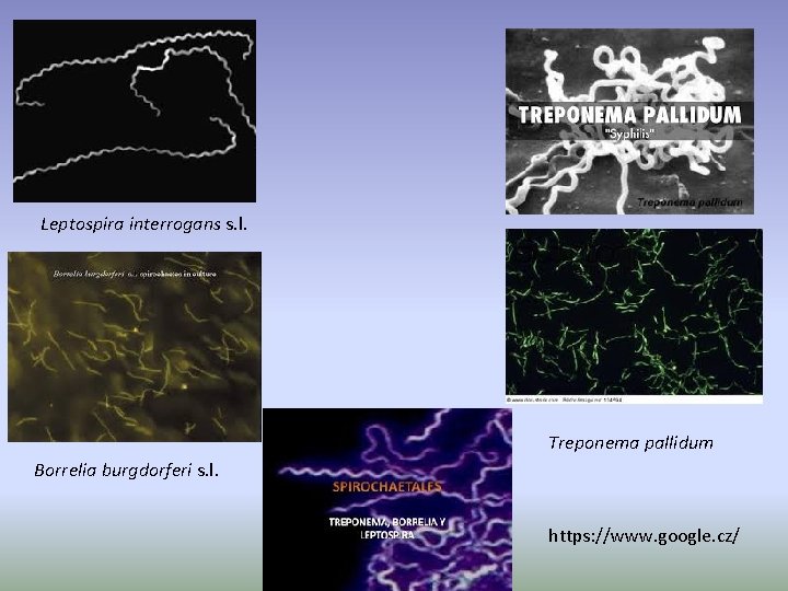 Leptospira interrogans s. l. Treponema pallidum Borrelia burgdorferi s. l. https: //www. google. cz/