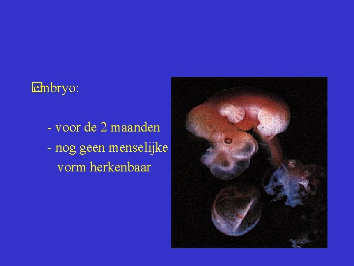  embryo: � - voor de 2 maanden - nog geen menselijke vorm herkenbaar