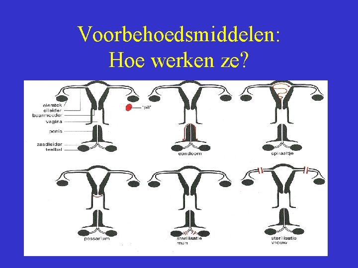 Voorbehoedsmiddelen: Hoe werken ze? 