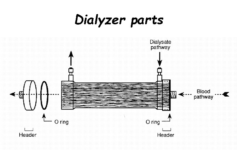 Dialyzer parts 