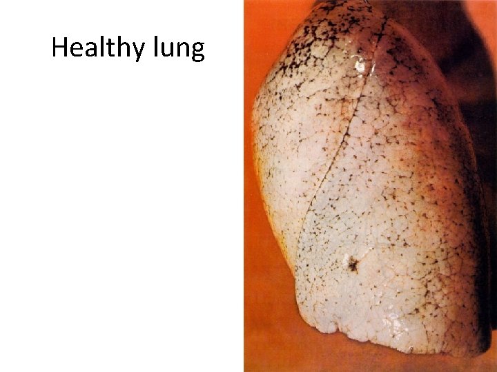Healthy lung 