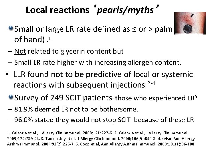 Local reactions ‘pearls/myths’ Small or large LR rate defined as ≤ or > palm