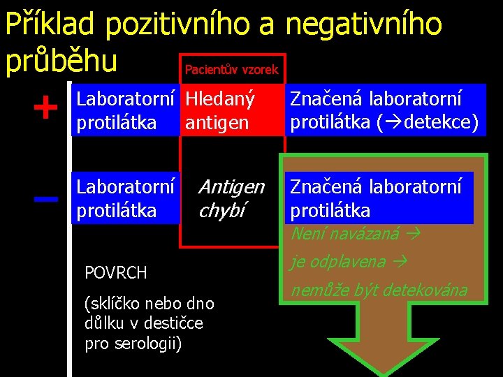 Příklad pozitivního a negativního průběhu Pacientův vzorek + Laboratorní Hledaný protilátka antigen Značená laboratorní