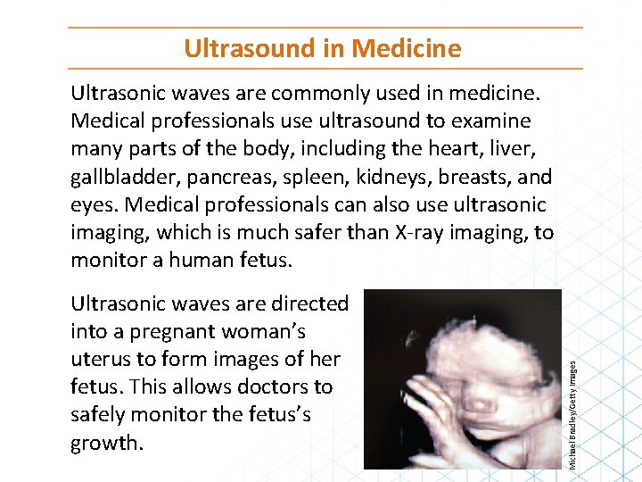 Ultrasound in Medicine Ultrasonic waves are directed into a pregnant woman’s uterus to form