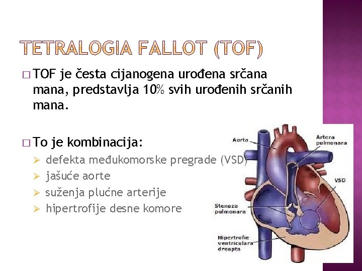 � TOF je česta cijanogena urođena srčana mana, predstavlja 10% svih urođenih srčanih mana.