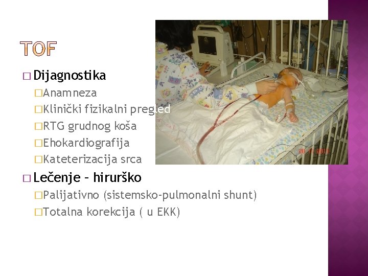 � Dijagnostika �Anamneza �Klinički fizikalni pregled �RTG grudnog koša �Ehokardiografija �Kateterizacija srca � Lečenje